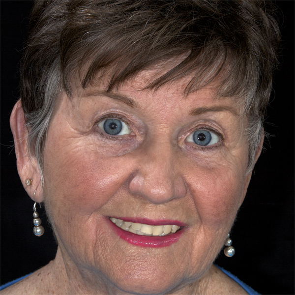 Phyllis Denton
